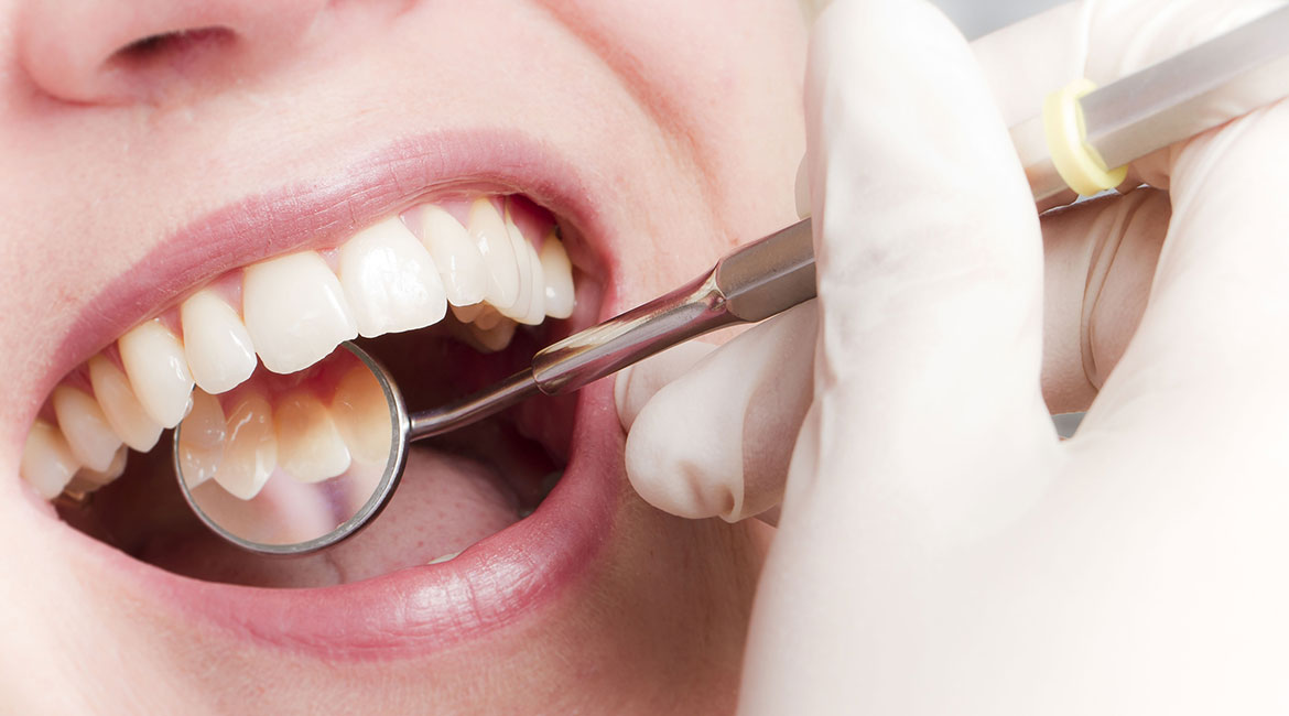 Retention: das Ergebnis nach Zahnkorrektur in Olpe erhalten